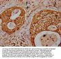 TNN Antibody