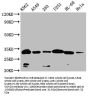 VDAC3 Antibody