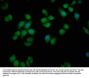 VDAC3 Antibody