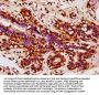 FHOD1 Antibody