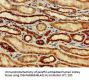 SNCAIP Antibody