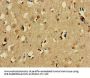 SNCAIP Antibody