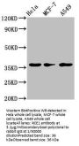 RCE1 Antibody