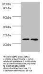 ASF1A Antibody