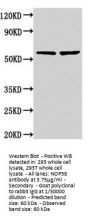 Rabbit anti-human Nucleolar protein 58 polyclonal Antibody