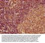 CCL27 Antibody