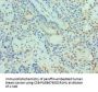 PIAS3 Antibody
