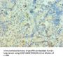PIAS3 Antibody