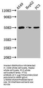 IFT52 Antibody