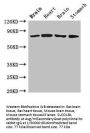 SLCO1B1 Antibody