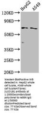 SLCO1B1 Antibody