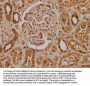 IVNS1ABP Antibody