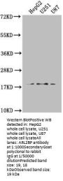 ARL2BP Antibody