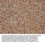 ARL2BP Antibody