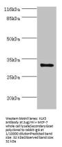 KLK5 Antibody