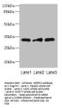 MRPS2 Antibody