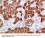 MME Antibody