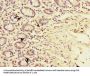 TIMM9 Antibody