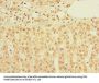 TIMM9 Antibody