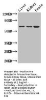 AK5 Antibody