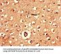 AK5 Antibody