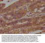 AXIN2 Antibody