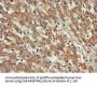 FARP1 Antibody