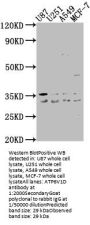 ATP6V1D Antibody