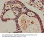 DIS3 Antibody