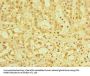 ZBTB32 Antibody