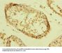 ZBTB32 Antibody