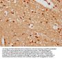 UTP18 Antibody