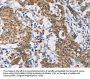 Rabbit anti-human CERK polyclonal antibody