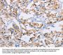 NCR3 Antibody