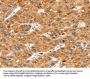SOX11 Antibody