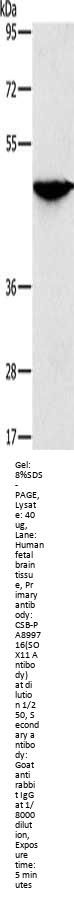 SOX11 Antibody