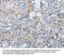 BTN2A2 Antibody