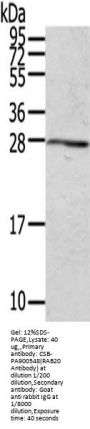 RAB20 Antibody