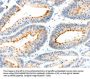 Rabbit anti-human MAP4K1 polyclonal antibody
