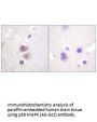 MAPK14 (Ab-322) Antibody
