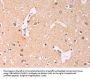 ADCY1 Antibody