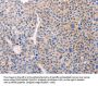 ADCY1 Antibody