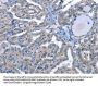 LRRK2 Antibody