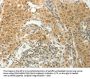 SLC8A3 Antibody