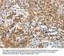 IL22RA1 Antibody