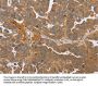 NMT1 Antibody