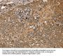 NMT1 Antibody