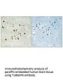 TUBGCP6 Antibody