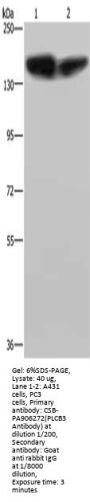 PLCB3 Antibody