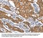 Rabbit anti-human CYLD polyclonal antibody